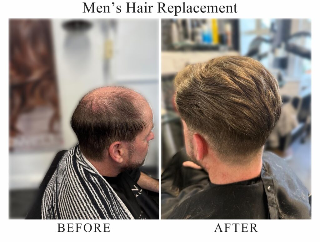 Men’s hair replacement, before and after: a thinning crown seen from the side, then full hair with a tapered back