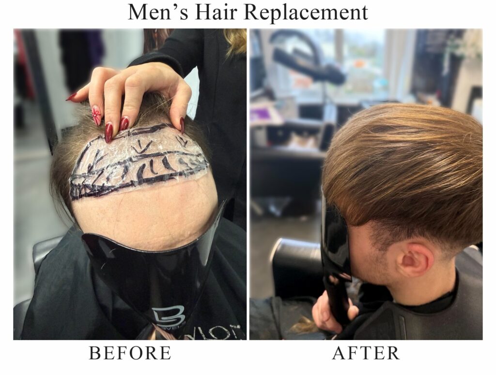 Men’s hair replacement, before and after: a template drawn on the scalp for a bespoke hair system, then the finished full hair