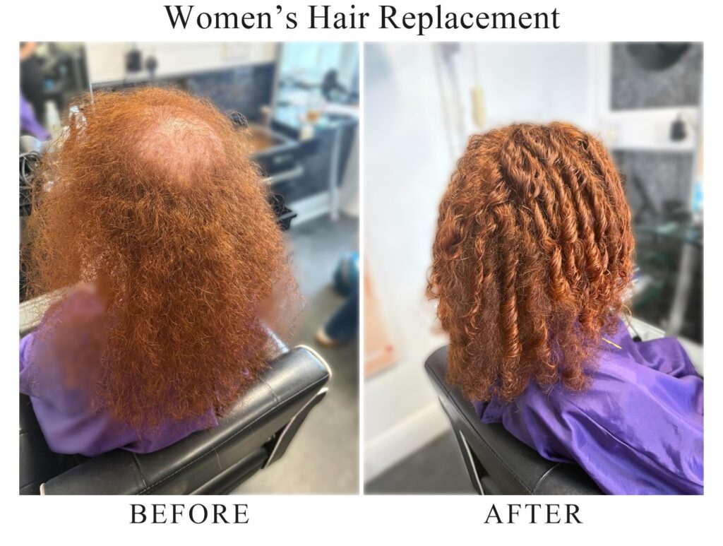 Women’s hair replacement, before and after: long red hair thinning on top, then full, defined red curls