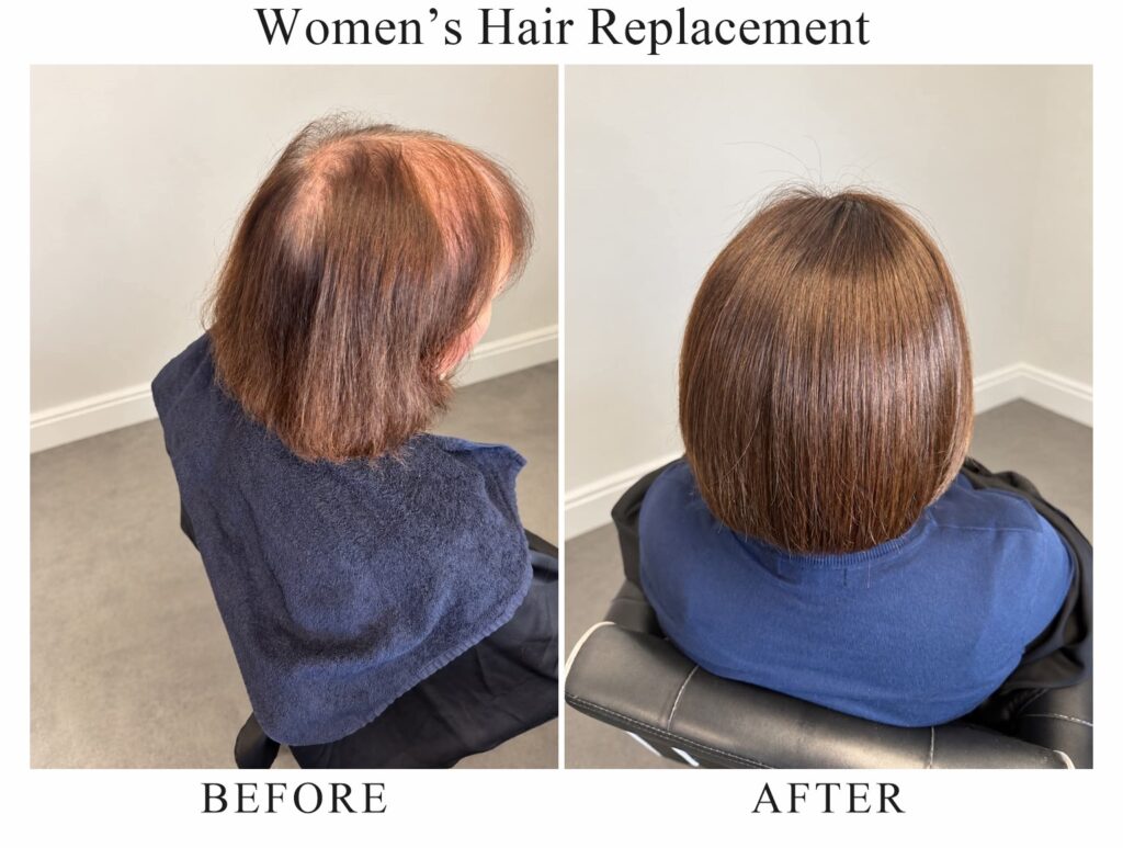 Women’s hair replacement, before and after: thinning hair from the side, then a full brown bob