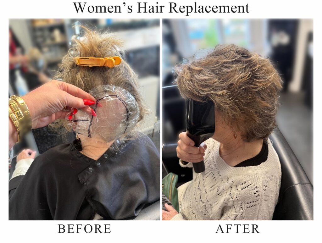 Women’s hair replacement, before and after: a template being fitted over the crown, then full, layered hair