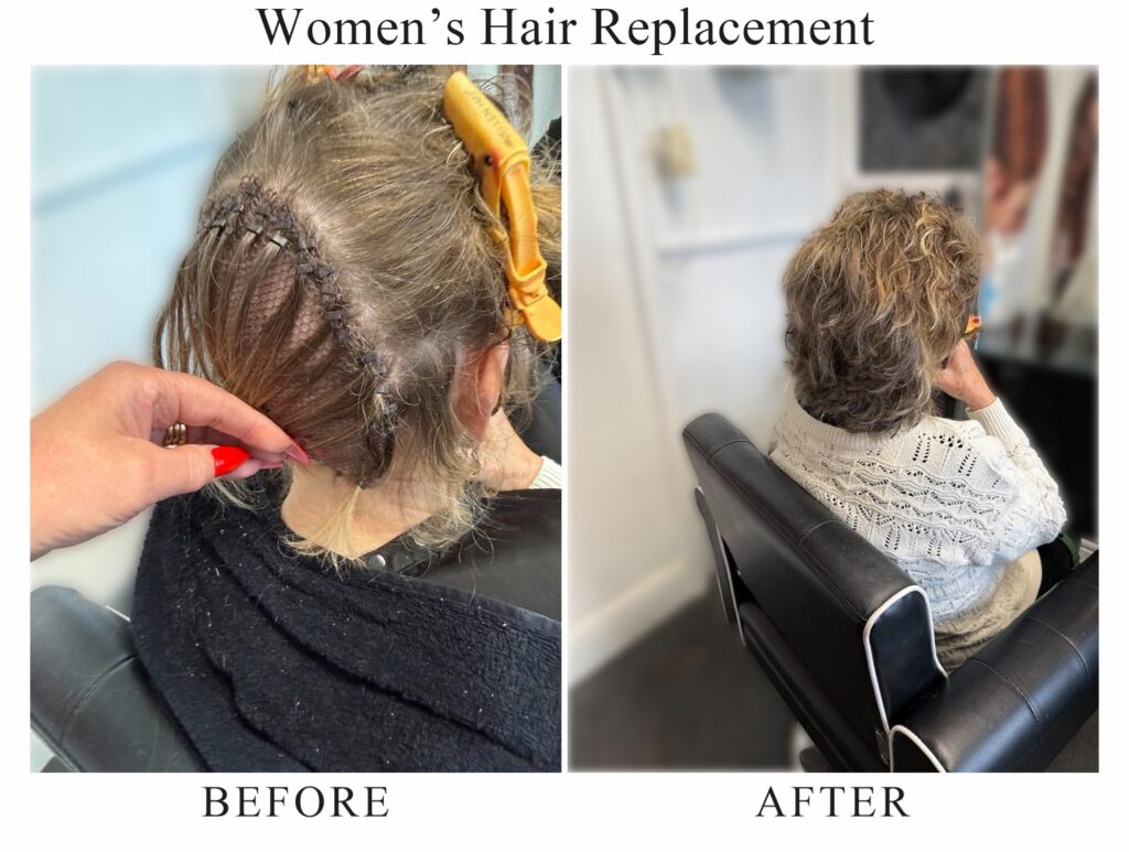 Women’s hair replacement, before and after: the hair being prepared at the back, then the finished layered style