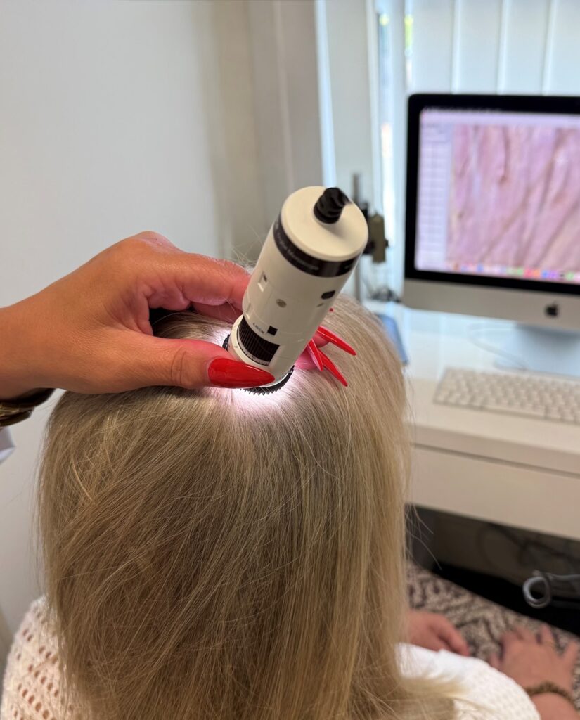 A trichologist examining a client’s scalp with a digital microscope, with the magnified view on a computer screen